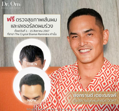 Slider image (6) The Best Medical Hair Center by Dr. Orn 